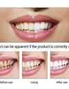 EFERO Teeth Whitening Essence Oral Hygiene Cleaning Serum