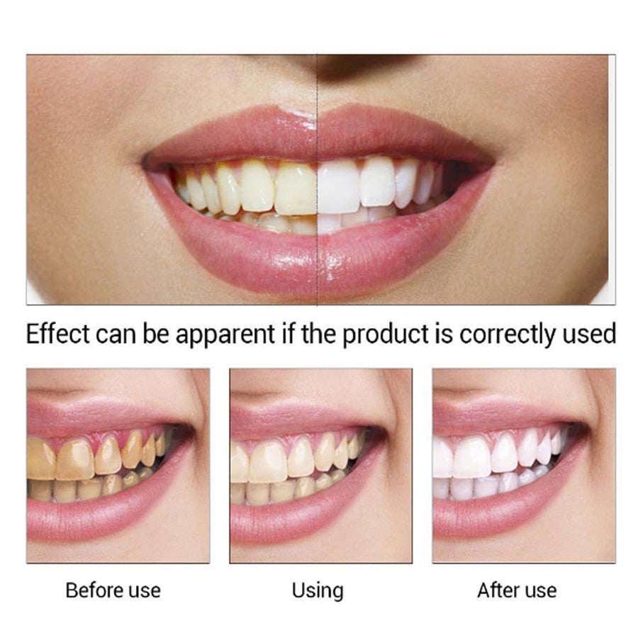 EFERO Teeth Whitening Essence Oral Hygiene Cleaning Serum